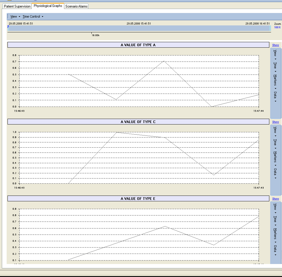 ICW Patient runtime physiological values graphical representations